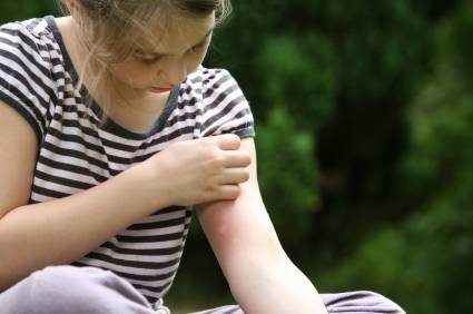 girl with mosquito bite, scratching hand has motion blur