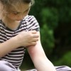 4 Reasons to Invest in a Mosquito Service