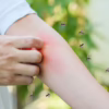 Health Risks of Mosquito Infestations
